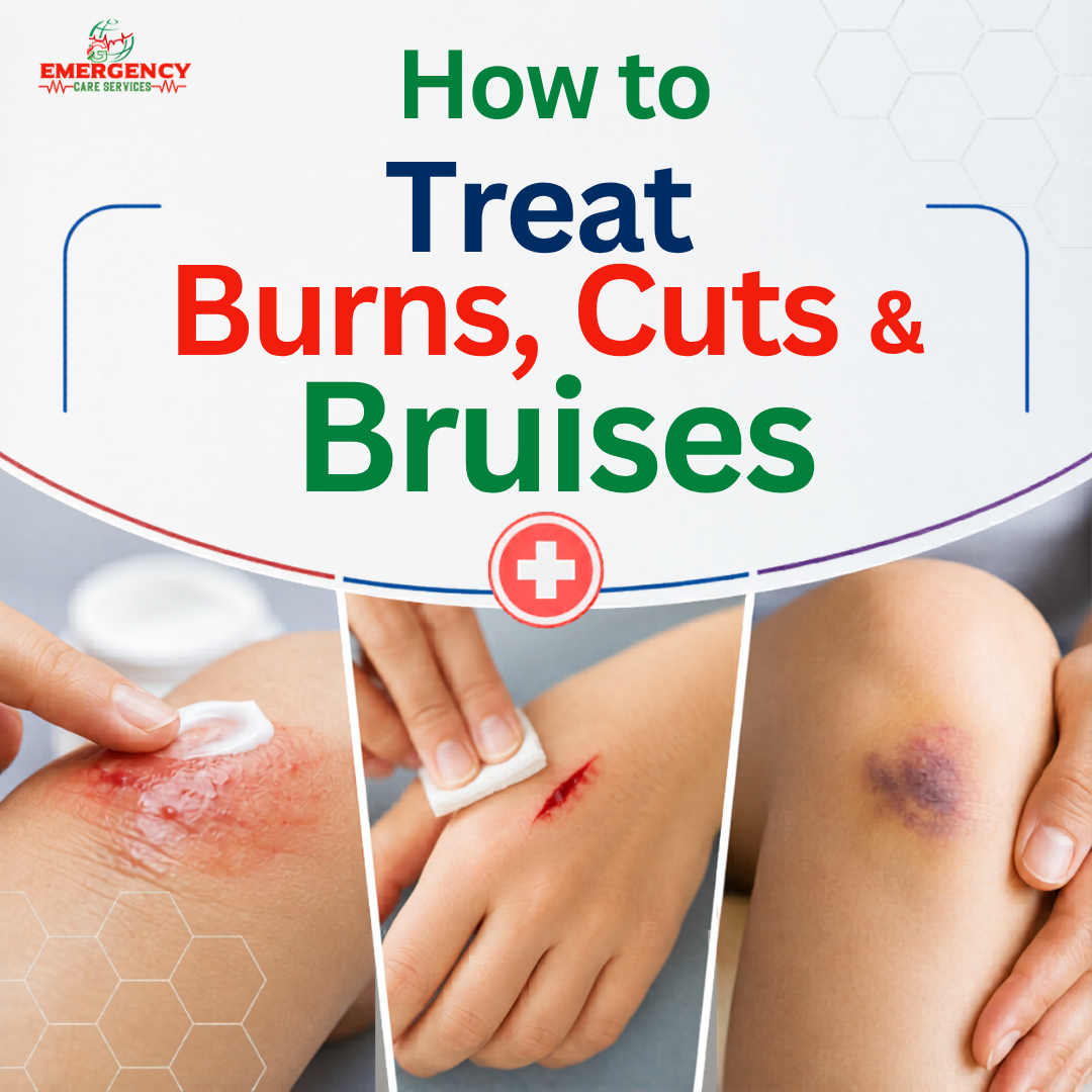 How to Treat Burns, Cuts & Bruises at Home the Right Way — A Complete First Aid Guide